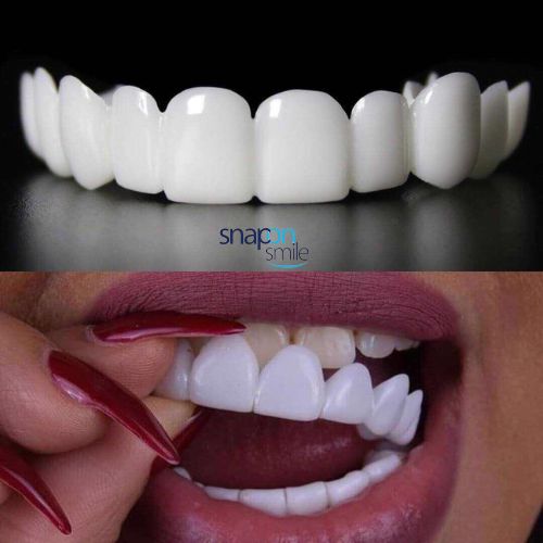 |SNAP ON SMILE| Diseño de Sonrisa INSTANTANEO de RESINA